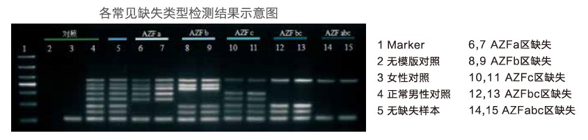 y染色体微缺失检测试剂盒(琼脂糖电泳检测)