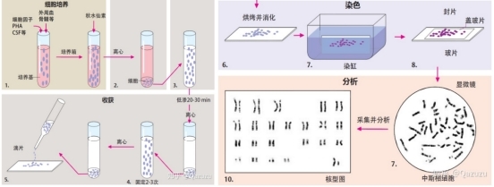 核型分析检测流程 图源知乎_一文读懂染色体核型分析_阅微基因